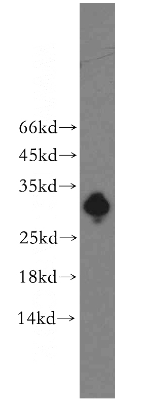 U-937 cells were subjected to SDS PAGE followed by western blot with Catalog No:111764(IL17F antibody) at dilution of 1:200