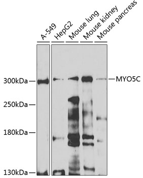 Western blot - MYO5C Polyclonal Antibody 