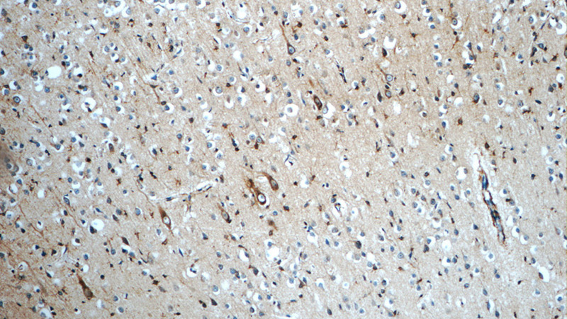 Immunohistochemistry of paraffin-embedded human brain tissue slide using Catalog No:113024(N-cadherin Antibody) at dilution of 1:50 (under 10x lens)