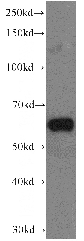 HepG2 cells were subjected to SDS PAGE followed by western blot with Catalog No:107251(EIF3D antibody) at dilution of 1:1000