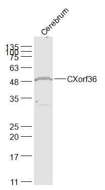 Fig3: Sample:; Cerebrum (Mouse) Lysate at 40 ug; Primary: Anti-CXorf36 at 1/1000 dilution; Secondary: IRDye800CW Goat Anti-Rabbit IgG at 1/20000 dilution; Predicted band size: 45 kD; Observed band size: 50 kD