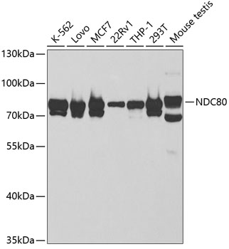 Western blot - NDC80 Polyclonal Antibody 