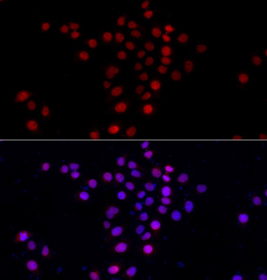Immunofluorescence - PI4K2A Polyclonal Antibody 