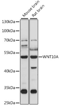 Western blot - WNT10A Polyclonal Antibody 