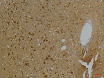 Fig2:; Immunohistochemical analysis of paraffin-embedded Rat BrainTissue using Kv10.2 Rabbit pAb diluted at 1:200.