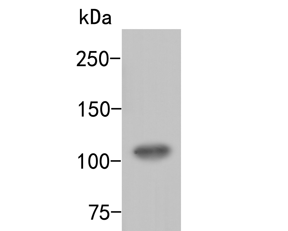 Fig1:; Western blot analysis of ARF16 on rice tissue lysate. Proteins were transferred to a PVDF membrane and blocked with 5% BSA in PBS for 1 hour at room temperature. The primary antibody ( 1/500) was used in 5% BSA at room temperature for 2 hours. Goat Anti-Rabbit IgG - HRP Secondary Antibody (HA1001) at 1:5,000 dilution was used for 1 hour at room temperature.