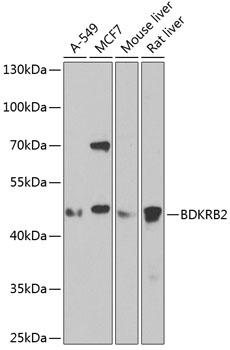 Western blot - BDKRB2 Polyclonal Antibody 