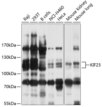 Western blot - KIF23 Polyclonal Antibody 