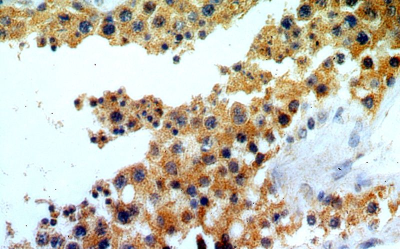 Immunohistochemical of paraffin-embedded human testis using Catalog No:110230(ELOVL2 antibody) at dilution of 1:50 (under 40x lens)