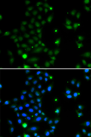 Immunofluorescence - GCM1 Polyclonal Antibody 