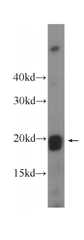 Human peripheral blood leukocyte cells were subjected to SDS PAGE followed by western blot with Catalog No:108026(APOBEC3C Antibody) at dilution of 1:1000