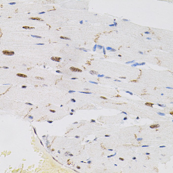 Immunohistochemistry - FAF1 Polyclonal Antibody 