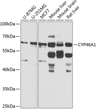 Western blot - CYP46A1 Polyclonal Antibody 