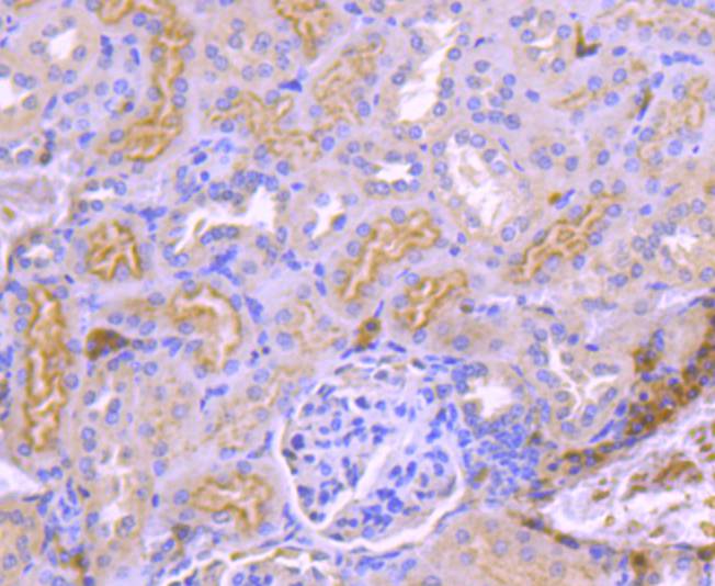 Fig8:; Immunohistochemical analysis of paraffin-embedded mouse kidney tissue using anti-TrkA antibody. The section was pre-treated using heat mediated antigen retrieval with Tris-EDTA buffer (pH 9.0) for 20 minutes.The tissues were blocked in 5% BSA for 30 minutes at room temperature, washed with ddH; 2; O and PBS, and then probed with the primary antibody ( 1/50) for 30 minutes at room temperature. The detection was performed using an HRP conjugated compact polymer system. DAB was used as the chromogen. Tissues were counterstained with hematoxylin and mounted with DPX.