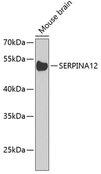 Western blot - SERPINA12 Polyclonal Antibody 