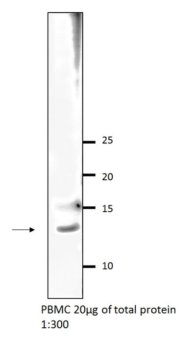 WB result of VAMP5 antibody (Catalog No:116708, 1:300) with PBMC cells. Proteintech αVAMP5 in 10% BSA / TBS 0.05% Tween-20 O/N @ 4°C Goat anti-rabbit HRP 1:10000 in 5% milk / TBS 0.05% Tween-20 1h @ RT.