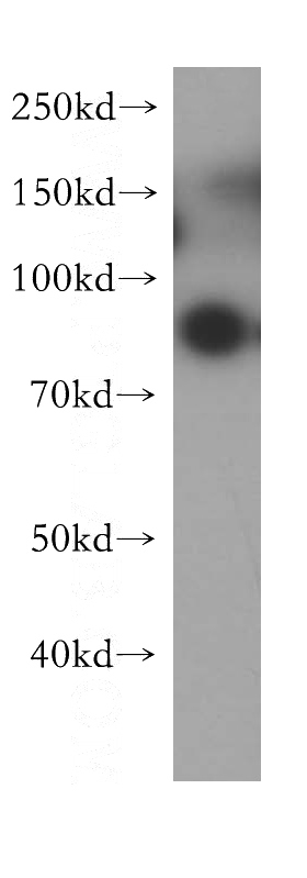 human placenta tissue were subjected to SDS PAGE followed by western blot with Catalog No:110917(G-CSF-R antibody) at dilution of 1:300