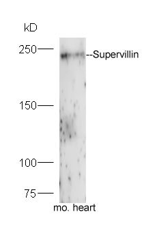 Fig1: Protein: mouse heart lysate;; Primary: rabbit Anti-Supervillin at 1:300;; Secondary: HRP conjugated Goat-Anti-rabbit IgG(bs-0295G-HRP) at 1: 5000;; Predicted band size:248 kD; Observed band size:248 kD