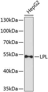 Western blot - LPL Polyclonal Antibody 