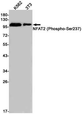 Western blot detection of NFAT2 (Phospho-Ser237) in K562,3T3 cell lysates using NFAT2 (Phospho-Ser237) Rabbit pAb(1:1000 diluted).Predicted band size:101kDa.Observed band size:101kDa.