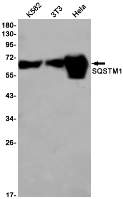 Western blot detection of SQSTM1 in K562,3T3,Hela cell lysates using SQSTM1 Rabbit pAb(1:1000 diluted).Predicted band size:48kDa.Observed band size:62kDa.