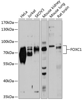 Western blot - FOXC1 Polyclonal Antibody 