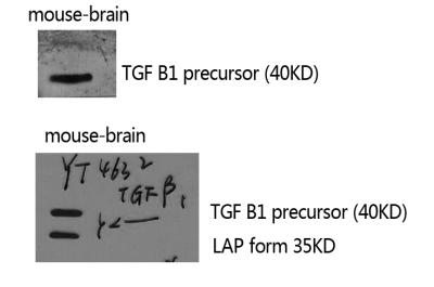 Western Blot analysis of mouse-brain using TGFu03b21 Polyclonal Antibody.