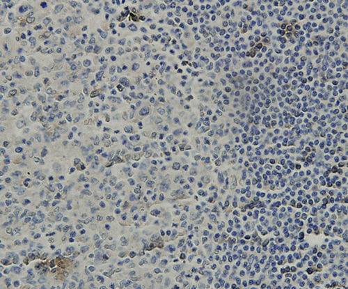 Fig5: Immunohistochemical analysis of paraffin-embedded human tonsil tissue using anti-C19orf35 antibody. Counter stained with hematoxylin.