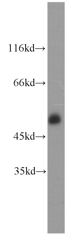 Jurkat cells were subjected to SDS PAGE followed by western blot with Catalog No:109065(CD2 antibody) at dilution of 1:1000