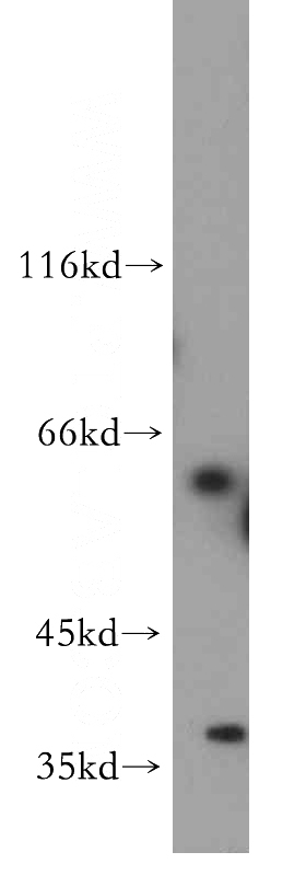 HepG2 cells were subjected to SDS PAGE followed by western blot with Catalog No:107760(ADAD2 antibody) at dilution of 1:500