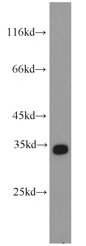 HEK-293 cells were subjected to SDS PAGE followed by western blot with Catalog No:114265(PTER antibody) at dilution of 1:400