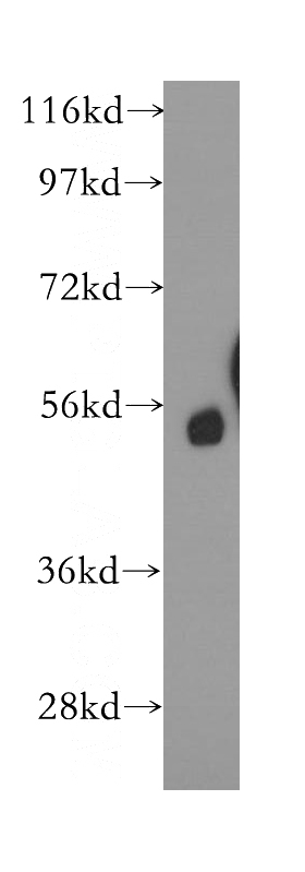 mouse testis tissue were subjected to SDS PAGE followed by western blot with Catalog No:108820(CAPS2 antibody) at dilution of 1:300