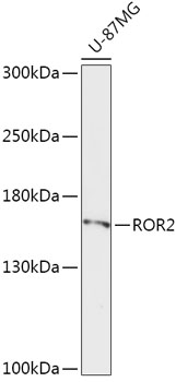 Western blot - ROR2 Polyclonal Antibody 