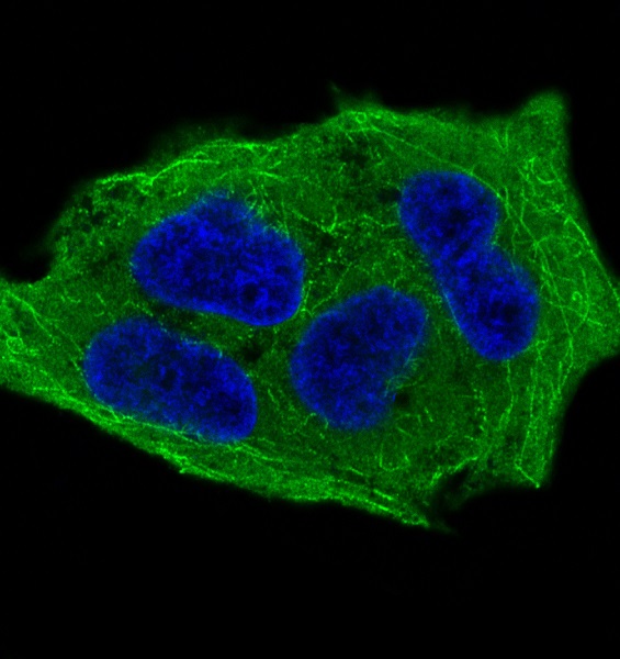 Immunofluorescent analysis of HeLa cells treated with Calyculin A, using Phospho-GSK3 beta (Ser9) Antibody.