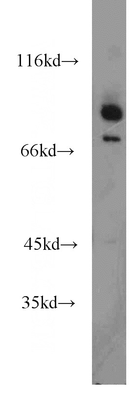 mouse kidney tissue were subjected to SDS PAGE followed by western blot with Catalog No:109930(DHX32 antibody) at dilution of 1:800