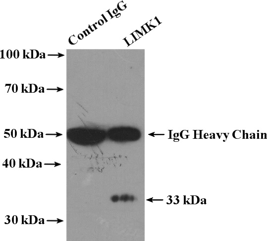 IP Result of anti-LIMK1 (IP:Catalog No:112228, 4ug; Detection:Catalog No:112228 1:800) with HeLa cells lysate 1600ug.