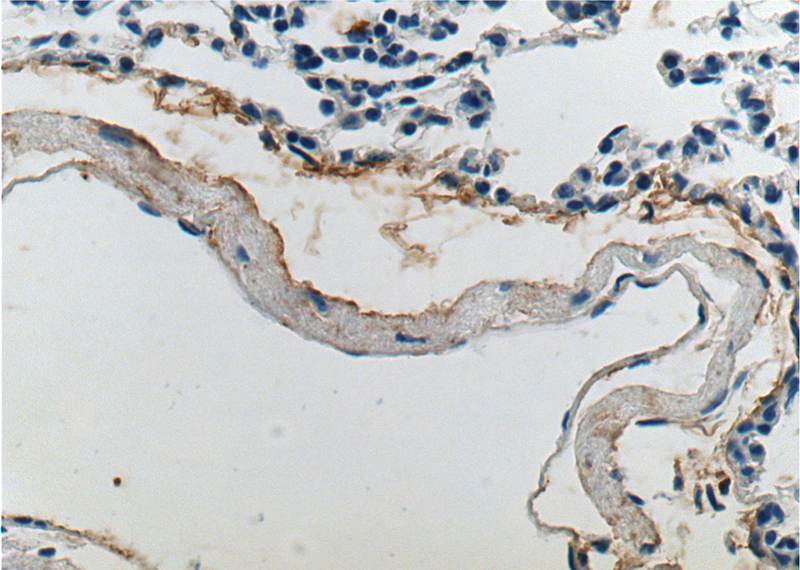 Immunohistochemistry of paraffin-embedded mouse lung tissue slide using Catalog No:110285(ELN Antibody) at dilution of 1:200 (under 40x lens).