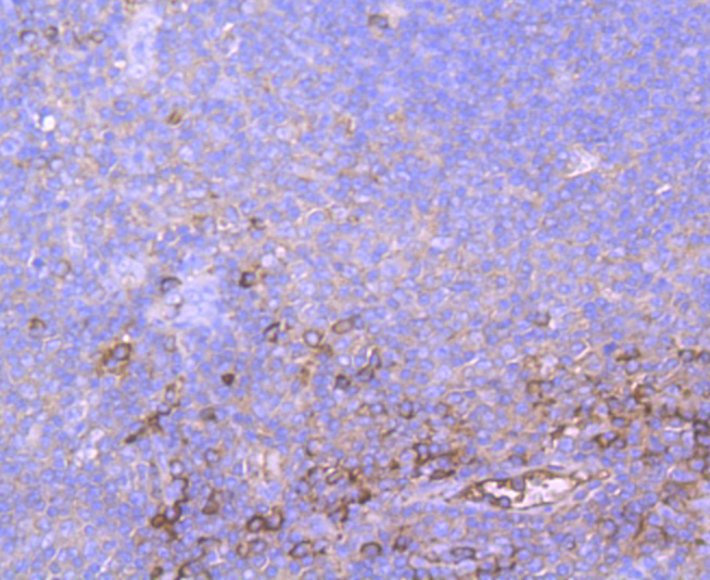 Fig2: Immunohistochemical analysis of paraffin-embedded human tonsil tissue using anti- A2M antibody. Counter stained with hematoxylin.