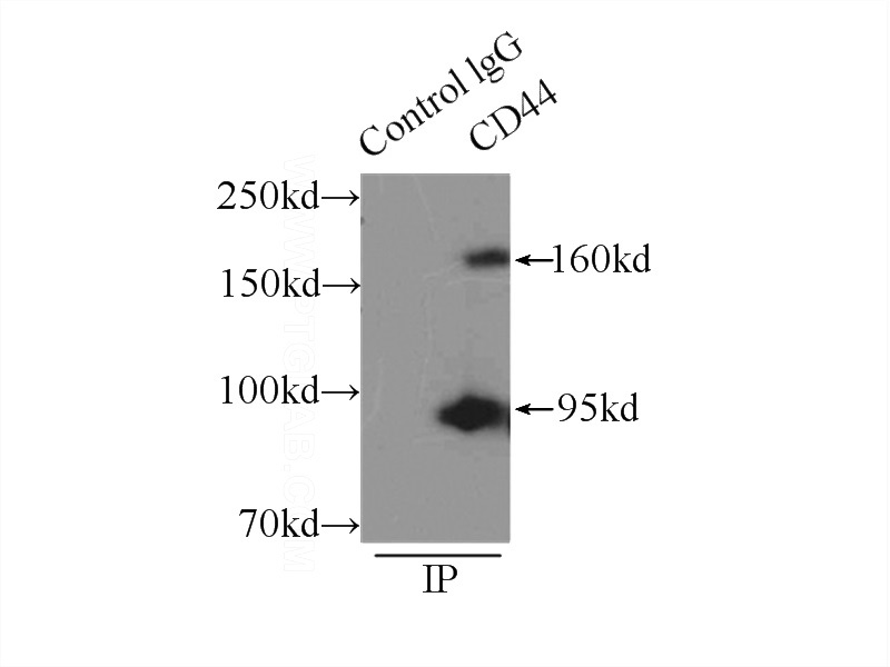 IP Result of anti-CD44 (IP:Catalog No:109124, 5ug; Detection:Catalog No:109124 1:800) with HeLa cells lysate 2500ug.