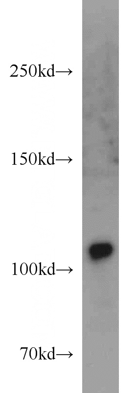 A549 cells were subjected to SDS PAGE followed by western blot with Catalog No:116587(USP11 antibody) at dilution of 1:1000