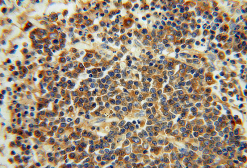 Immunohistochemical of paraffin-embedded human spleen using Catalog No:111691(IGK- antibody) at dilution of 1:100 (under 40x lens)