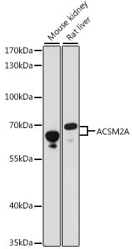 Western blot - ACSM2A Polyclonal Antibody 