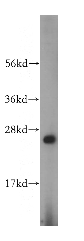 Jurkat cells were subjected to SDS PAGE followed by western blot with Catalog No:116885(YIPF4 antibody) at dilution of 1:500