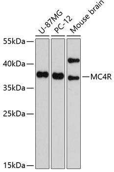 Western blot - MC4R Polyclonal Antibody 