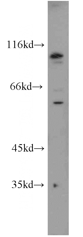 HeLa cells were subjected to SDS PAGE followed by western blot with Catalog No:108696(NCRNA00153 antibody) at dilution of 1:1000