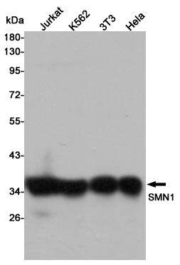 Western blot detection of SMN1 in Jurkat,K562,3T3 and Hela cell lysates using SMN1 mouse mAb (1:3000 diluted).Predicted band size:39KDa.Observed band size:35KDa.