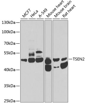 Western blot - TSEN2 Polyclonal Antibody 