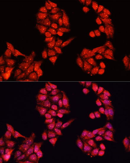 Immunofluorescence - ALDH9A1 Polyclonal Antibody 