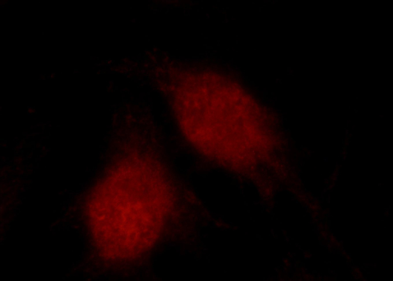 Immunofluorescent analysis of HUVEC cells using Catalog No:108880(Caspase 9 Antibody) at dilution of 1:25 and Rhodamine-Goat anti-Rabbit IgG