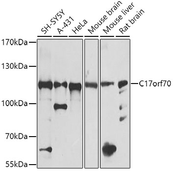 Western blot - C17orf70 Polyclonal Antibody 